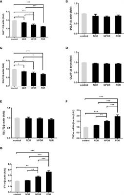 Decreased expression of Glucagon-like peptide-1 receptor and Sodium-glucose co-transporter 2 in patients with proliferative diabetic retinopathy
